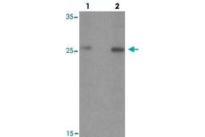 Western blot analysis of PTPRD in HeLa cell lysate with PTPRD polyclonal antibody  at (lane 1) 1 and (lane 2) 2 ug/mL. (PTPRD anticorps  (N-Term))