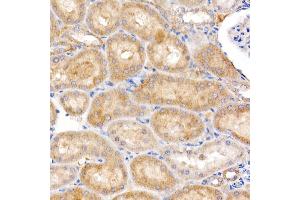 Immunohistochemistry of paraffin-embedded rat kidney using MT-ND4 Rabbit pAb (ABIN7268602) at dilution of 1:250 (40x lens). (Mitochondrially Encoded NADH Dehydrogenase 4 (MT-ND4) anticorps)