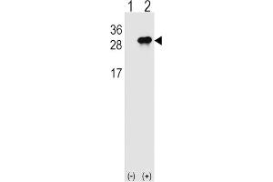Western Blotting (WB) image for anti-Interleukin 28B (Interferon, lambda 3) (IL28B) antibody (ABIN2999039) (IL28B anticorps)