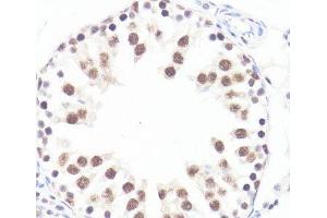 Immunohistochemistry of paraffin-embedded Rat testis using Phospho-MYC(S62) Polyclonal Antibody at dilution of 1:100 (40x lens).