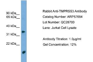WB Suggested Anti-TMPRSS3  Antibody Titration: 0.