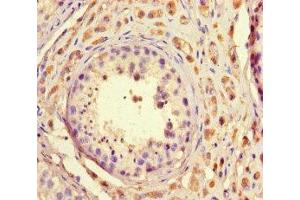 Immunohistochemistry of paraffin-embedded human testis tissue using ABIN7172681 at dilution of 1:100 (TAF2 anticorps  (AA 400-450))