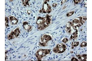 Image no. 1 for anti-Cytidine Monophosphate (UMP-CMP) Kinase 1, Cytosolic (CMPK1) antibody (ABIN1497545)