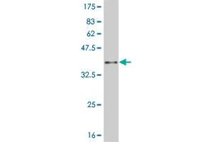 Western Blot detection against Immunogen (37.