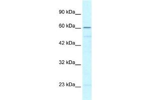 WB Suggested Anti-ZNF212 Antibody Titration:  0. (ZNF212 anticorps  (N-Term))