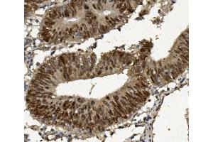 IHC analysis of FOXP1 using anti-FOXP1 antibody (ABIN7602780). (FOXP1 anticorps  (C-Term))