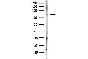Western blot analysis of lysates from PC12 cells(heat-shock,45 min treatment), using Phospho-Tau (Thr492/Thr175) Antibody at 1/1000 dilution.