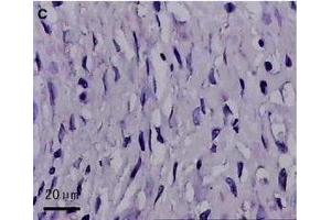 Haematoxylin and eosin and CD177 IHC staining in AS-affected and -unaffected oviduct tissues.
