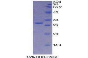 SDS-PAGE analysis of Human BRCA2 Protein. (BRCA2 Protéine)