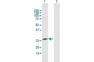 Western Blot analysis of GOSR2 expression in transfected 293T cell line by GOSR2 MaxPab polyclonal antibody. (GOSR2 anticorps  (AA 1-213))