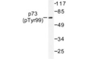 Image no. 1 for anti-Tumor Protein P73 (TP73) (pTyr99) antibody (ABIN318099) (Tumor Protein p73 anticorps  (pTyr99))