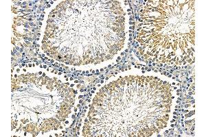 ABIN7095536 and ABIN7099593 at 1/100 staining rat testis tissue by IHC-P. (FBXO4 anticorps)