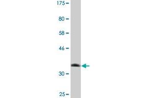 Western Blot detection against Immunogen (37. (RASA3 anticorps  (AA 725-834))