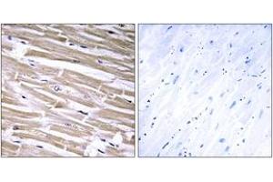 Immunohistochemistry analysis of paraffin-embedded human heart tissue, using B3GALT2 Antibody.