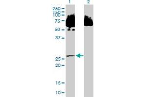 Western Blot analysis of SDR39U1 expression in transfected 293T cell line by SDR39U1 MaxPab polyclonal antibody. (SDR39U1 anticorps  (AA 1-293))