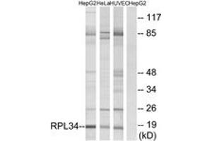 Western blot analysis of extracts from HepG2/HeLa/HuvEc cells, using RPL34 Antibody. (RPL34 anticorps  (AA 41-90))