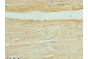 Immunohistochemistry of paraffin-embedded human skeletal muscle tissue using ABIN7169356 at dilution of 1:100 (SERTAD1 anticorps  (AA 1-236))