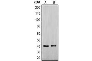 Western blot analysis of ENDOGL1 expression in Jurkat (A), HepG2 (B) whole cell lysates. (EXOG anticorps  (Center))
