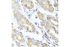 Immunohistochemistry of paraffin-embedded human gastric using DARS2 antibody at dilution of 1:100 (x40 lens). (DARS2 anticorps)