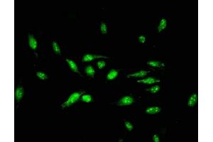 Immunofluorescent analysis of Hela cells using ABIN7150372 at dilution of 1:100 and Alexa Fluor 488-congugated AffiniPure Goat Anti-Rabbit IgG(H+L)