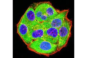 Immunofluorescence analysis of Hela cells using ADAR mouse mAb (green).