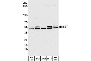 Western Blotting (WB) image for anti-SET Nuclear Oncogene (SET) (AA 125-175) antibody (ABIN7454812)