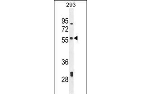 LARP6 anticorps  (N-Term)