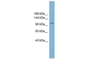ACLY antibody used at 1 ug/ml to detect target protein. (ACLY anticorps  (Middle Region))