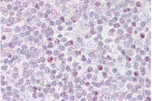 Immunohistochemistry with Thymus tissue at an antibody concentration of 5µg/ml using anti-EBF1 antibody (ARP39578_P050)