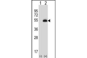Western blot analysis of X6 (arrow) using rabbit polyclonal X6 Antibody (ABIN656844 and ABIN2846051). (PAX6 anticorps)