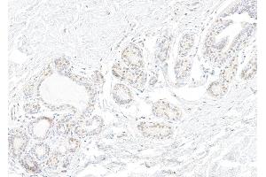 Immunohistochemistry (IHC) image for anti-Small Nuclear Ribonucleoprotein 200kDa (U5) (SNRNP200) (AA 400-450) antibody (ABIN7454918)