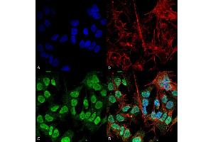 Immunocytochemistry/Immunofluorescence analysis using Mouse Anti-Alpha Synuclein Monoclonal Antibody, Clone 3F8 (ABIN5564104).