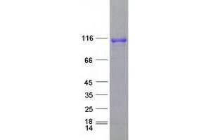 Validation with Western Blot