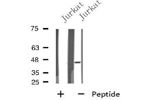 Western blot analysis of extracts from Jurkat cells, using EDG7 antibody. (LPAR3 anticorps  (Internal Region))