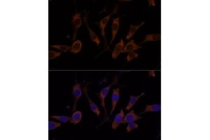Immunofluorescence analysis of L929 cells using RPL32 Polyclonal Antibody (ABIN6129104, ABIN6147138, ABIN6147139 and ABIN6216824) at dilution of 1:100 (40x lens).