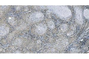 IHC analysis of EEF2/Elongation factor 2 using anti-EEF2/Elongation factor 2 antibody (ABIN7603142). (EEF2 anticorps  (N-Term))