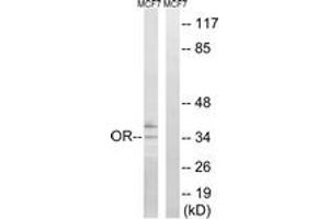 Western blot analysis of extracts from MCF-7 cells, using OR51H1 Antibody. (OR51H1 anticorps  (AA 201-250))