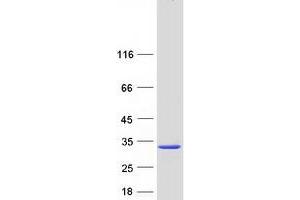 Validation with Western Blot