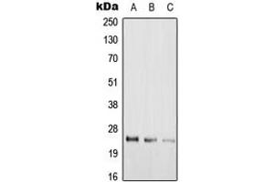 Western blot analysis of RAB39A expression in Hela (A), rat lung (B), H9C2 (C) whole cell lysates.