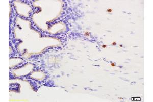 Formalin-fixed and paraffin embedded rat seminal vesicle labeled with Anti-Phospho-Dab1 (Tyr232) Polyclonal Antibody, Unconjugated (ABIN684343) at 1:200 followed by conjugation to the secondary antibody and DAB staining. (DAB1 anticorps  (pTyr232))