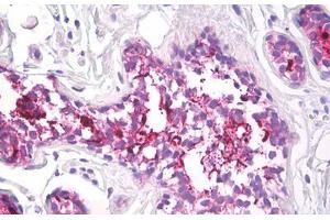 Image no. 2 for anti-Mucin 1 (MUC1) antibody (ABIN1502278)