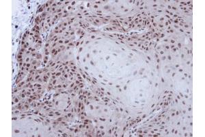 IHC-P Image Immunohistochemical analysis of paraffin-embedded Cal27 xenograft, using p54/nrb , antibody at 1:100 dilution. (NONO anticorps  (N-Term))