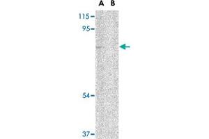 Western blot analysis of UIMC1 in 293 cell lysate in (A) the absence and (B) presence of blocking peptide with UIMC1 polyclonal antibody  at 1 ug/mL . (UIMC1 anticorps  (N-Term))