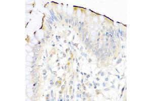 Immunohistochemistry of paraffin-embedded human colon using NRG4 antibody at dilution of 1:100 (40x lens). (Neuregulin 4 anticorps)
