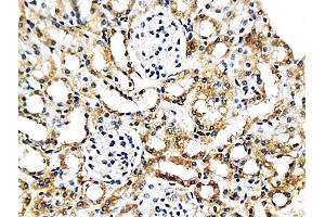 Formalin-fixed and paraffin embedded mouse kidney labeled with Anti-MCP-2 Polyclonal Antibody, Unconjugated (ABIN676283) at 1:200 followed by conjugation to the secondary antibody and DAB staining (CCL8 anticorps  (AA 24-99))