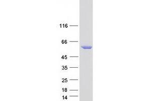 Validation with Western Blot