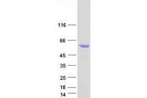 Validation with Western Blot (STK32C Protein (Myc-DYKDDDDK Tag))