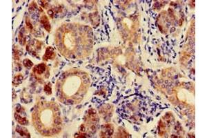 Immunohistochemistry of paraffin-embedded human salivary gland tissue using ABIN7146731 at dilution of 1:100 (CA6 anticorps  (AA 17-172))
