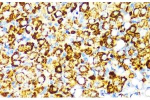 Immunohistochemistry of paraffin-embedded Rat ovary using PBEF / NAMPT Polyclonal Antibody at dilution of 1:100 (40x lens). (NAMPT anticorps)