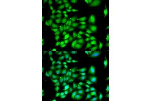 Immunofluorescence analysis of A549 cells using TREX1 antibody (ABIN5974106). (TREX1 anticorps)